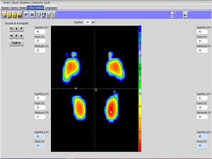Zona de quiropodología